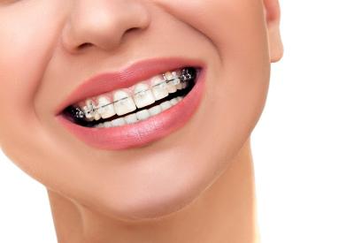 Ostéopathie et orthodontie Ostéopathie et orthodontie